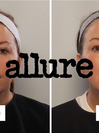 Allure: August 2026